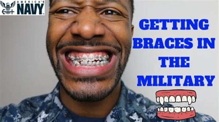 Can You Have Braces In The Military