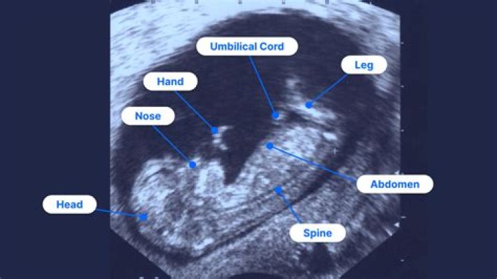 How to read an ultrasound